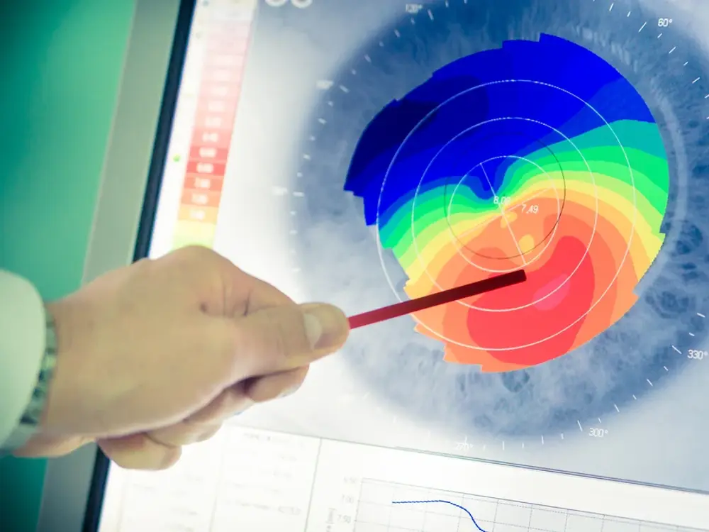 Keratoconus Specialists of Maryland office in Baltimore
