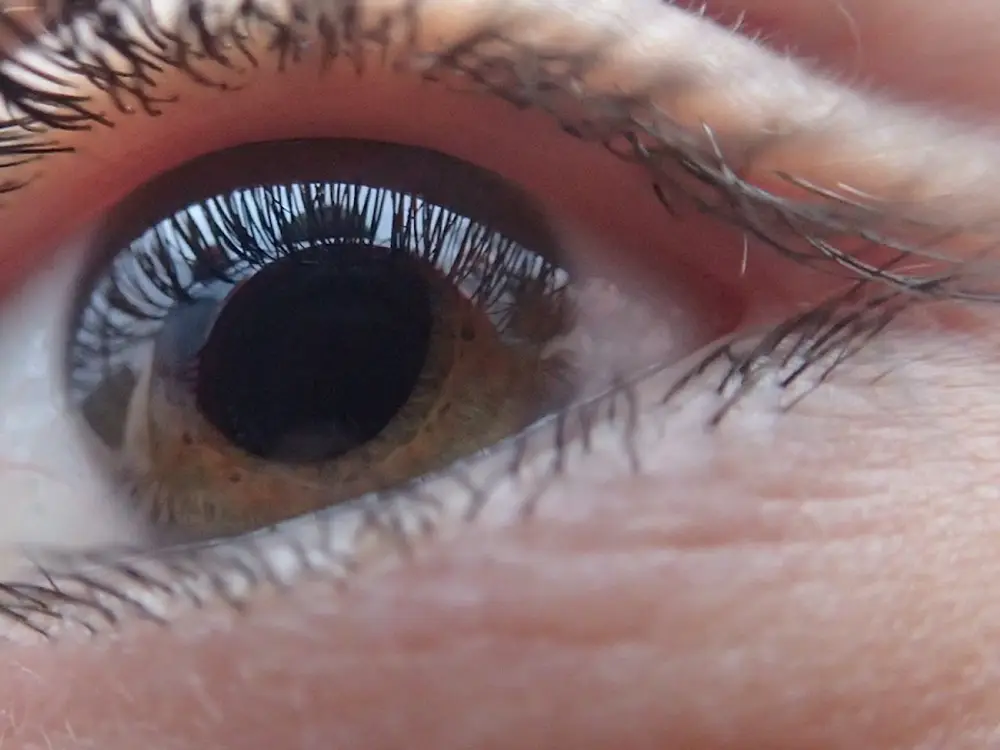 Vision One Lasik Center office in Arlington Heights
